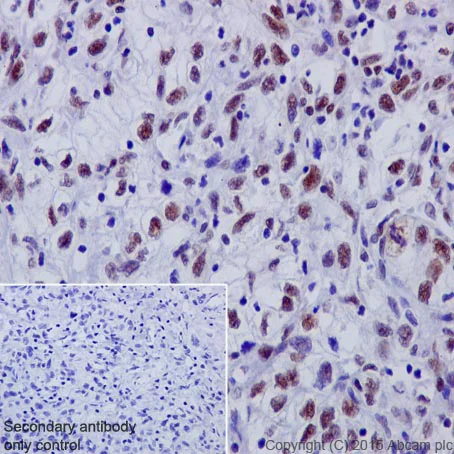 Immunohistochemistry (Formalin/PFA-fixed paraffin-embedded sections) - Anti-53BP1 antibody [EPR2172(2)] - BSA and Azide free (AB222232)