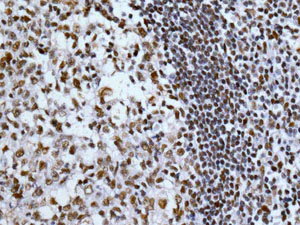 Immunohistochemistry (Formalin/PFA-fixed paraffin-embedded sections) - Anti-53BP1 antibody [EPR2172(2)] - BSA and Azide free (AB222232)
