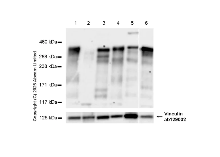 Western blot - Anti-53BP1 antibody [EPR2173(2)] (AB175188)