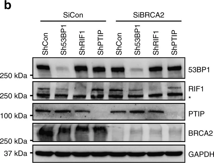 Western blot - Anti-53BP1 antibody [EPR2173(2)] (AB175188)
