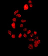 Immunocytochemistry/ Immunofluorescence - Anti-53BP1 antibody [EPR2173(2)] - BSA and Azide free (AB249845), expandable thumbnail