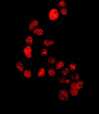 Immunocytochemistry/ Immunofluorescence - Anti-53BP1 antibody [EPR2173(2)] - BSA and Azide free (AB249845)