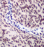 Immunohistochemistry (Formalin/PFA-fixed paraffin-embedded sections) - Anti-53BP1 antibody [EPR2173(2)] - BSA and Azide free (AB249845), expandable thumbnail