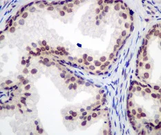 Immunohistochemistry (Formalin/PFA-fixed paraffin-embedded sections) - Anti-53BP1 antibody [EPR2173(2)] - BSA and Azide free (AB249845)