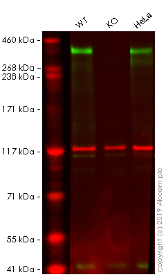 Western blot - Anti-53BP1 antibody [EPR2173(2)] - BSA and Azide free (AB249845), expandable thumbnail
