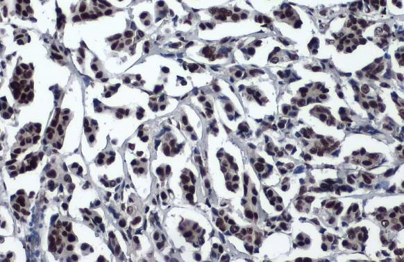 Immunohistochemistry paraffin embedded sections - Anti-53BP1 antibody [HL275] (AB308375)