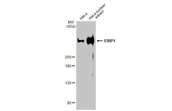 Western blot - Anti-53BP1 antibody [HL275] (AB308375)