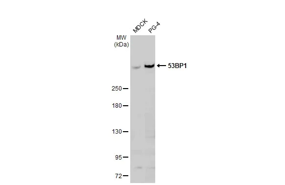 Western blot - Anti-53BP1 antibody [HL275] (AB308375)
