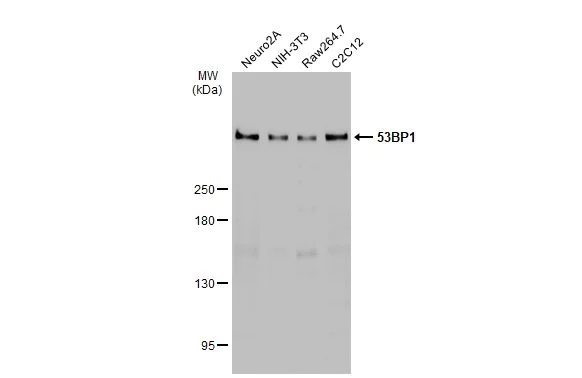 Western blot - Anti-53BP1 antibody [HL275] (AB308375)