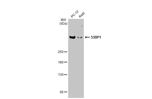 Western blot - Anti-53BP1 antibody [HL275] (AB308375)