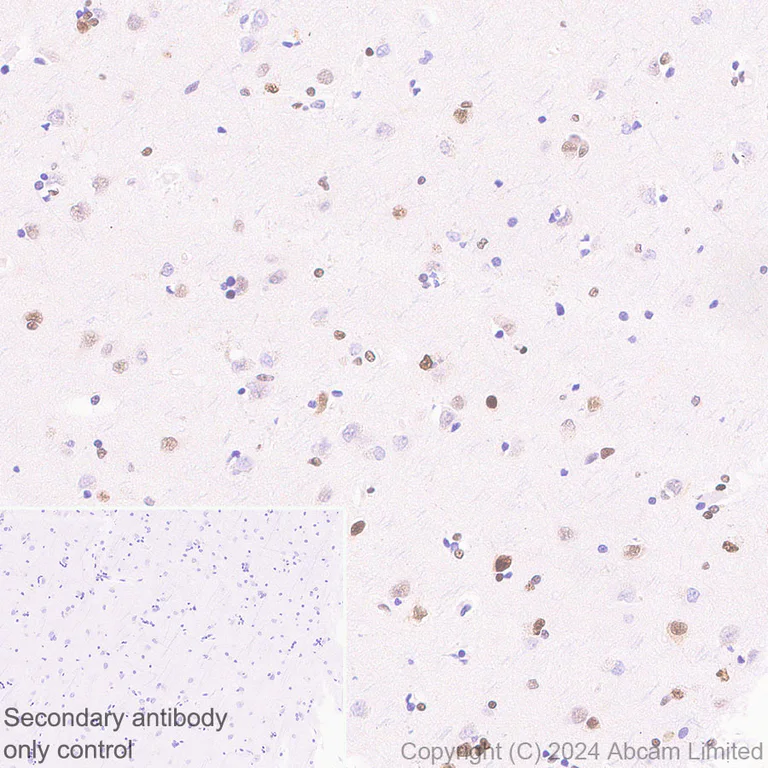 Immunohistochemistry (Formalin/PFA-fixed paraffin-embedded sections) - Anti-53BP1 antibody [RM1222] (AB320755)