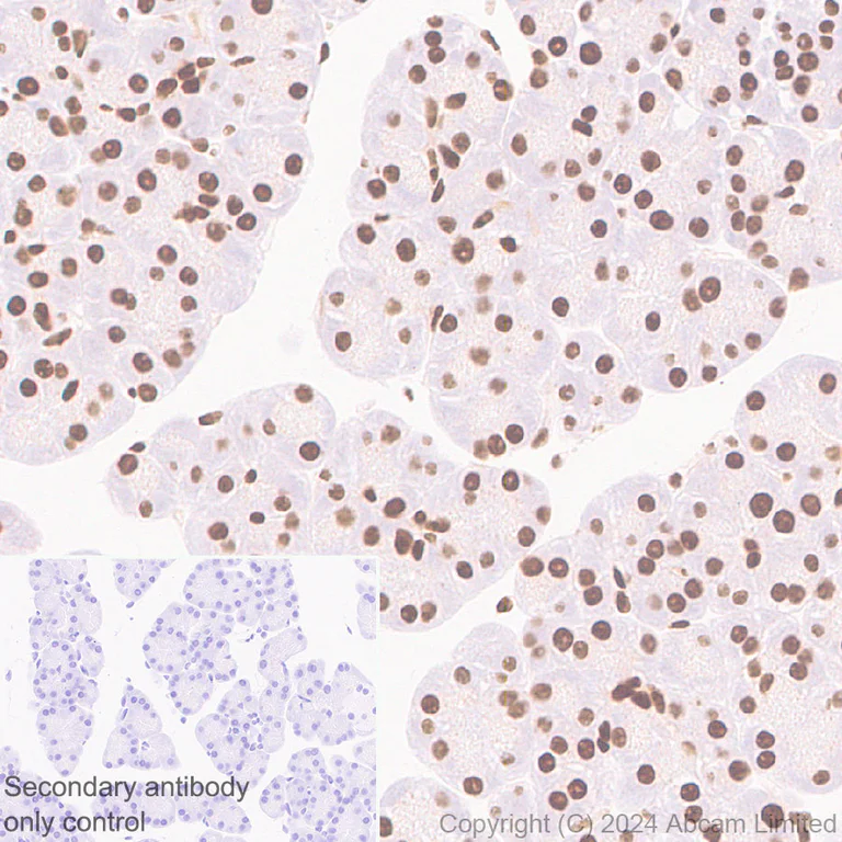 Immunohistochemistry (Formalin/PFA-fixed paraffin-embedded sections) - Anti-53BP1 antibody [RM1222] (AB320755)