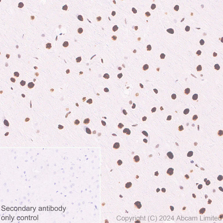 Immunohistochemistry (Formalin/PFA-fixed paraffin-embedded sections) - Anti-53BP1 antibody [RM1222] (AB320755)