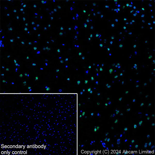 Immunohistochemistry (Frozen sections) - Anti-53BP1 antibody [RM1222] (AB320755)