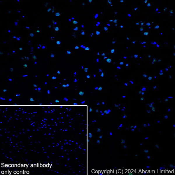 Immunohistochemistry (Frozen sections) - Anti-53BP1 antibody [RM1222] (AB320755)
