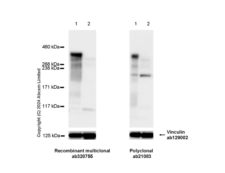 Western blot - Anti-53BP1 antibody [RM1222] (AB320755)