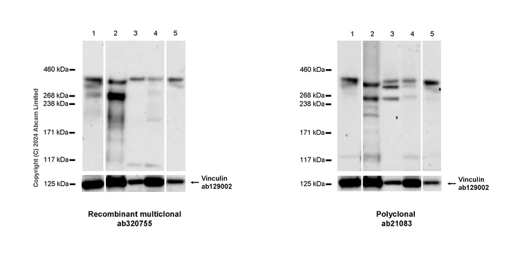 Western blot - Anti-53BP1 antibody [RM1222] (AB320755)
