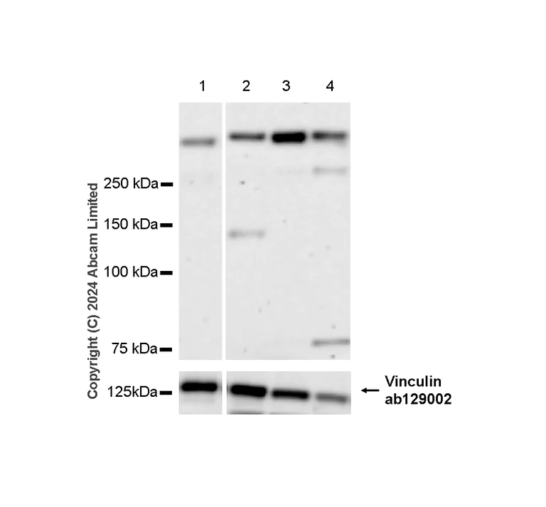 Western blot - Anti-53BP1 antibody [RM1222] (AB320755)