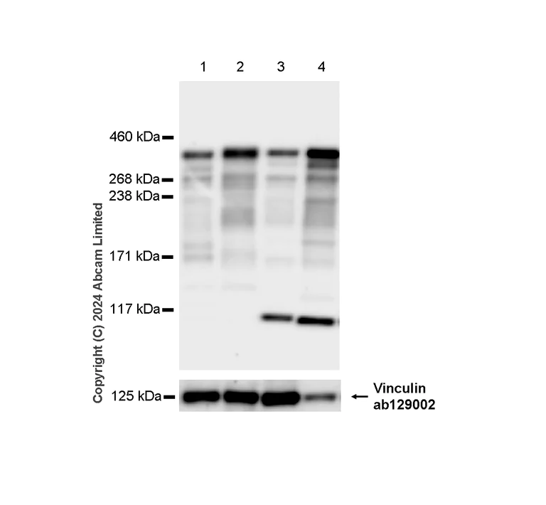 Western blot - Anti-53BP1 antibody [RM1222] (AB320755)