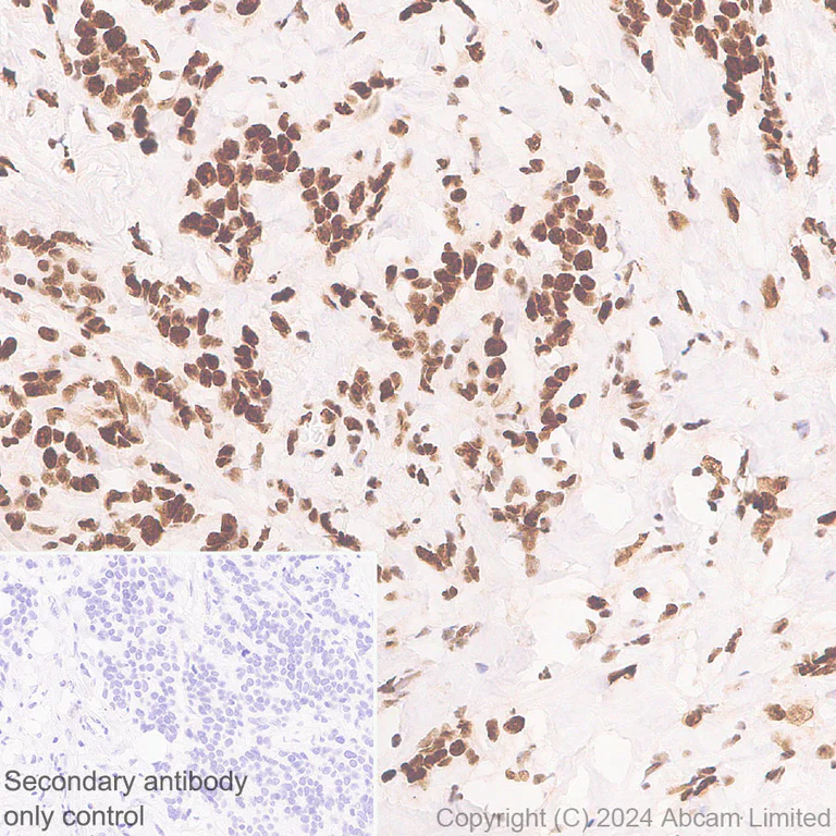 Immunohistochemistry (Formalin/PFA-fixed paraffin-embedded sections) - Anti-53BP1 antibody [RM1222] - BSA and Azide free (AB320756)