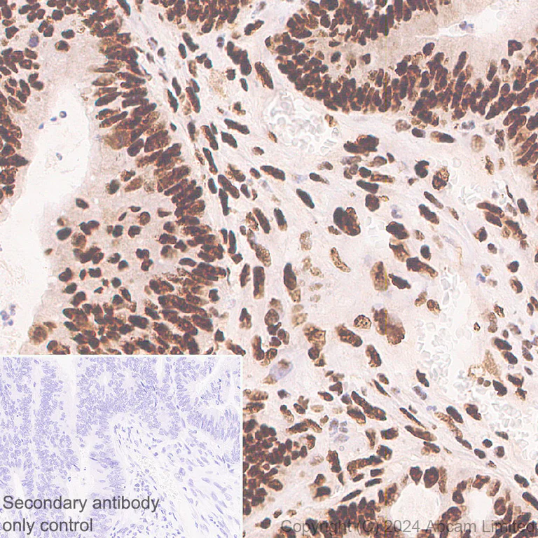 Immunohistochemistry (Formalin/PFA-fixed paraffin-embedded sections) - Anti-53BP1 antibody [RM1222] - BSA and Azide free (AB320756)