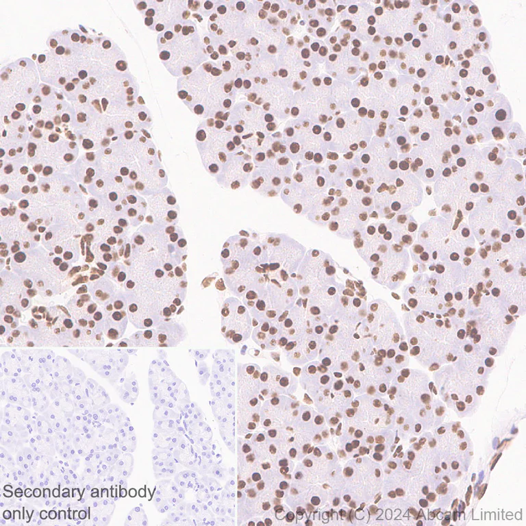 Immunohistochemistry (Formalin/PFA-fixed paraffin-embedded sections) - Anti-53BP1 antibody [RM1222] - BSA and Azide free (AB320756)