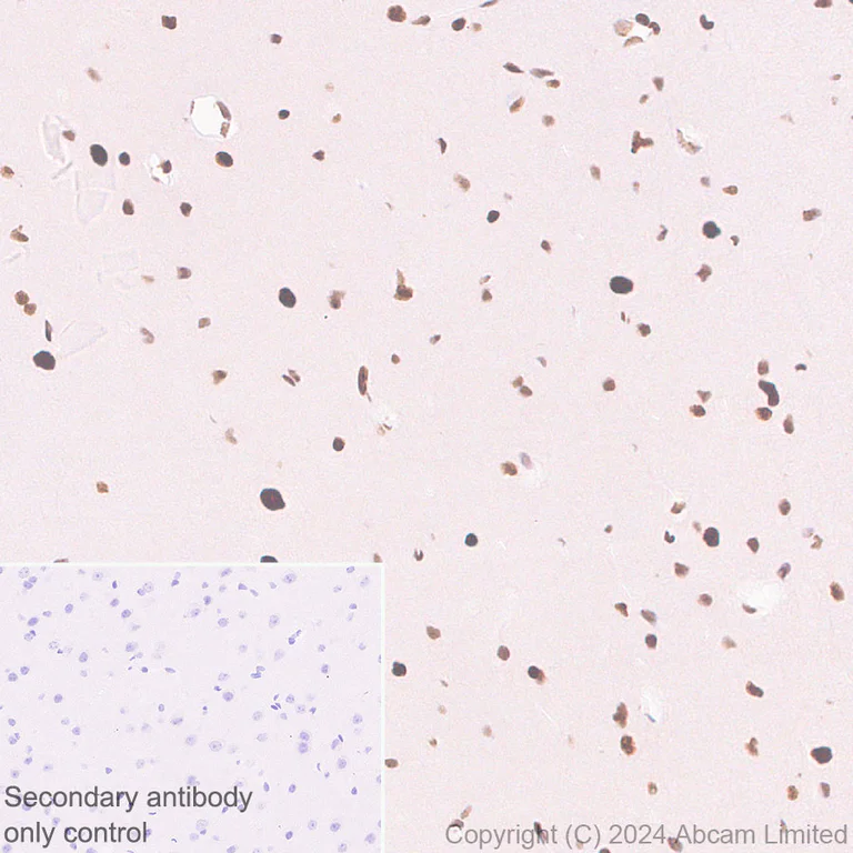 Immunohistochemistry (Formalin/PFA-fixed paraffin-embedded sections) - Anti-53BP1 antibody [RM1222] - BSA and Azide free (AB320756)