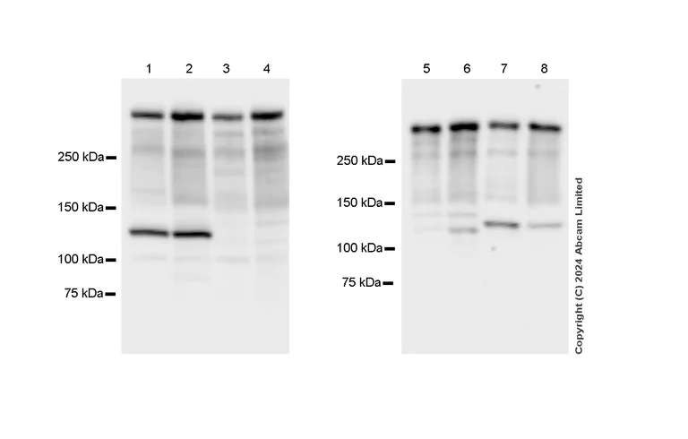 Western blot - Anti-53BP1 antibody [RM1222] - BSA and Azide free (AB320756)