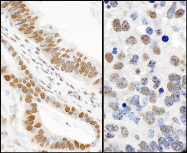 Immunohistochemistry (Formalin/PFA-fixed paraffin-embedded sections) - Anti-53BP1 (phospho S25) antibody (AB70323), expandable thumbnail