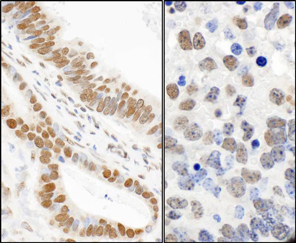 Immunohistochemistry (Formalin/PFA-fixed paraffin-embedded sections) - Anti-53BP1 (phospho S25) antibody (AB70323)