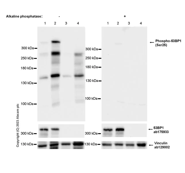 Western blot - Anti-53BP1 (phospho S25) antibody [EPR27057-33] (AB315015)