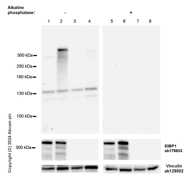 Western blot - Anti-53BP1 (phospho T543) antibody [EPR27059-168] (AB316316)