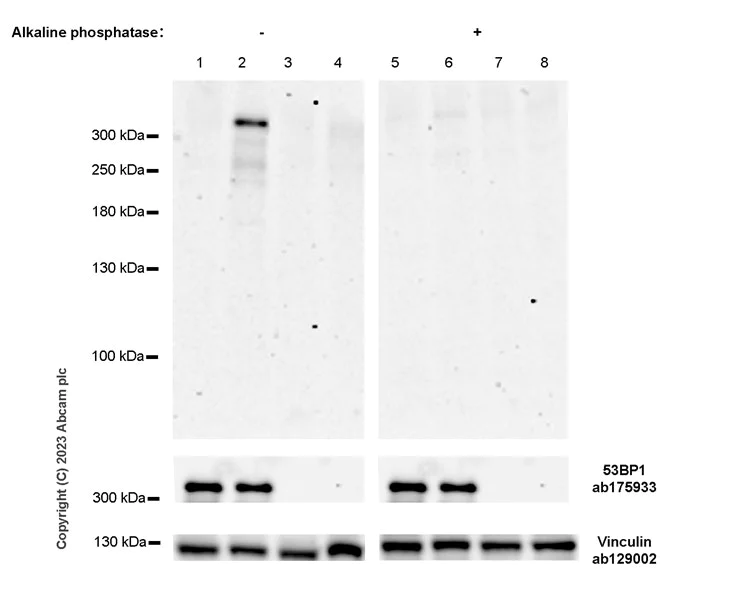 Western blot - Anti-53BP1 (phospho T670) antibody [EPR27060-30] (AB314866)