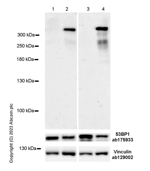 Western blot - Anti-53BP1 (phospho T670) antibody [EPR27060-30] (AB314866)