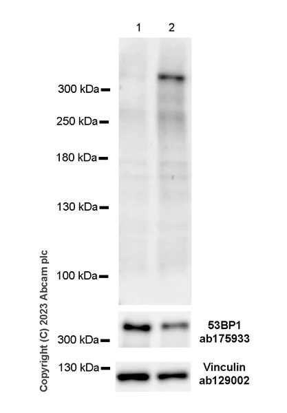 Western blot - Anti-53BP1 (phospho T670) antibody [EPR27060-30] (AB314866)