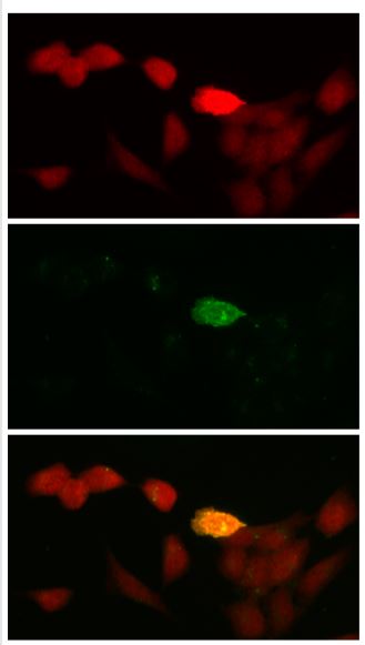 Immunocytochemistry/ Immunofluorescence - Anti-53BP2/ASPP2/BBP antibody (AB236448), expandable thumbnail