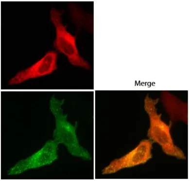 Immunocytochemistry/ Immunofluorescence - Anti-53BP2/ASPP2/BBP antibody (AB236448)
