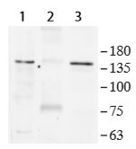 Immunoprecipitation - Anti-53BP2/ASPP2/BBP antibody (AB236448), expandable thumbnail