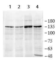 Western blot - Anti-53BP2/ASPP2/BBP antibody (AB236448)