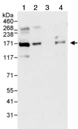 Western blot - Anti-53BP2/ASPP2/BBP antibody (AB70548)