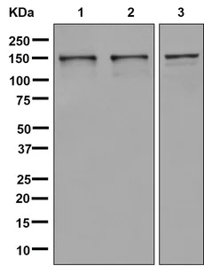 Western blot - Anti-53BP2/ASPP2/BBP antibody [EPR13837] (AB181377)