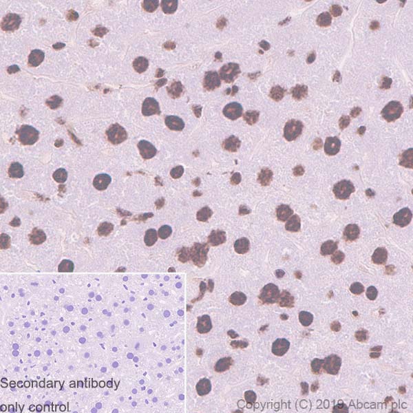Immunohistochemistry (Formalin/PFA-fixed paraffin-embedded sections) - Anti-53BP2/ASPP2/BBP antibody [EPR13837] - BSA and Azide free (AB250500), expandable thumbnail