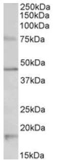 Western blot - Anti-5HT1A Receptor antibody (AB121032)