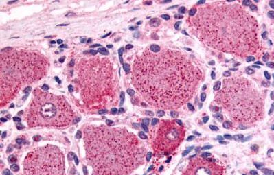Immunohistochemistry (Formalin/PFA-fixed paraffin-embedded sections) - Anti-5HT1D Receptor antibody (AB140486)
