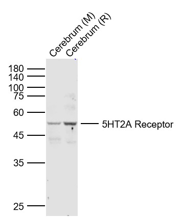 Western blot - Anti-5HT2A Receptor antibody (AB216959)