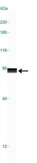 Western blot - Anti-5HT3A receptor/5ht3 antibody (AB13897), expandable thumbnail