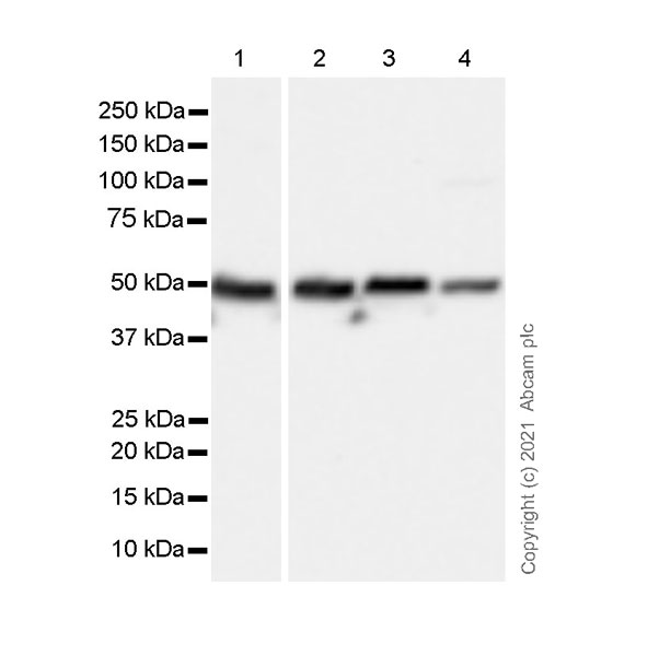 Western blot - Anti-5HT3A receptor/5ht3 antibody [EPR24323-75] (AB271031), expandable thumbnail