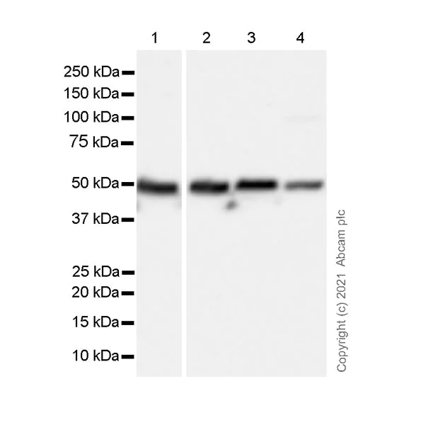 Western blot - Anti-5HT3A receptor/5ht3 antibody [EPR24323-75] (AB271031)