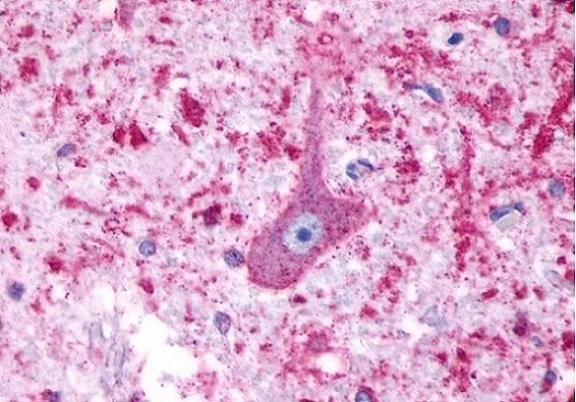 Immunohistochemistry (Formalin/PFA-fixed paraffin-embedded sections) - Anti-5HT4 Receptor antibody (AB219116)