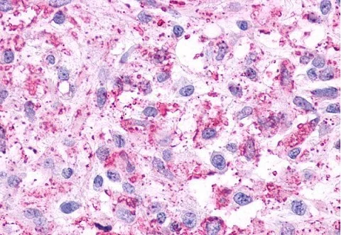 Immunohistochemistry (Formalin/PFA-fixed paraffin-embedded sections) - Anti-5HT4 Receptor antibody (AB219116)